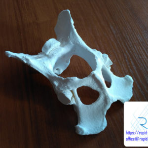 druk-3d-kosc-miednica-tomografia (3) druk 3d kości miednicy edukacja medycyna