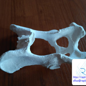 druk-3d-kosc-miednica-tomografia (4) druk 3d kości miednicy edukacja medycyna